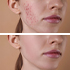 DERMATOLOŠKE 
INFORMACIJE
!