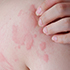 DERMATOLOŠKE 
INFORMACIJE
!